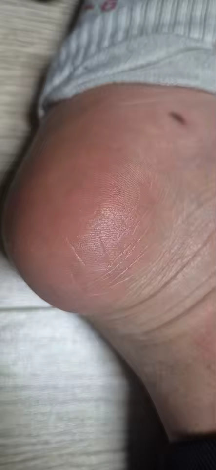 Foto del producto recibido